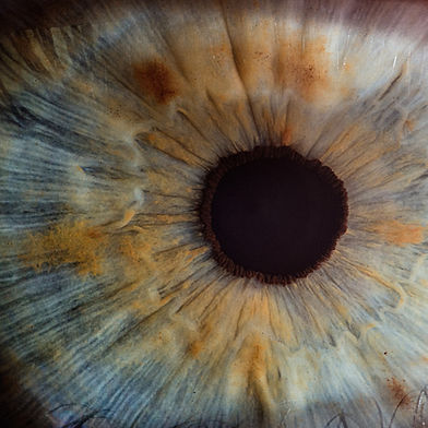 Irisdiagnose, Augendiagnose München