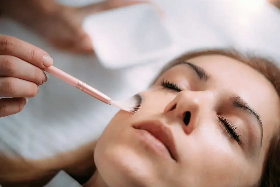 Chemical Peels in Scottsdale: What to Know Before Your Treatment