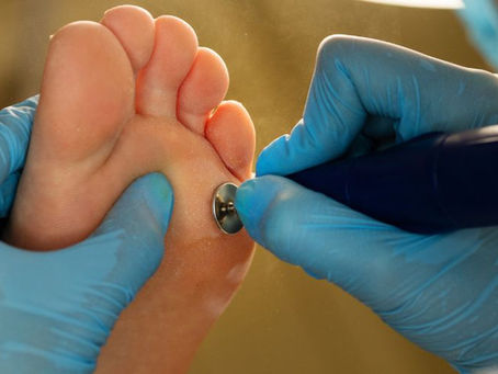 Diabetic Foot Doctor in Greater Kailash