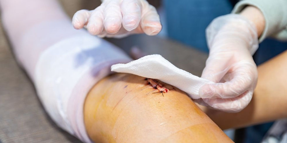 wound treatment in Delhi