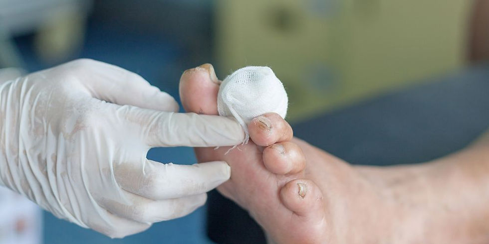 Diabetic Foot Treatment in Delhi