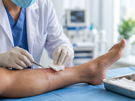 wound surgery in Delhi