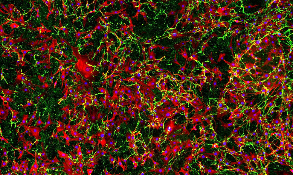 Doctorate in Biotechnology and Bioentrepreneurship