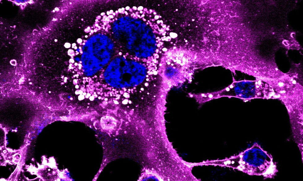 Doctorate in Immunology and Microbiology