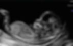 Ultraschall Geschlechterbestimmung
