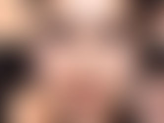 Understanding Various Kinds of Skin Pigmentation