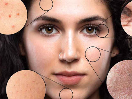Understanding Various Kinds of Skin Pigmentation