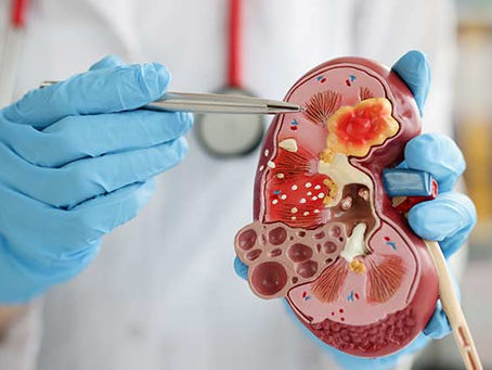 Understanding Kidney Function: What They Do and Why You Should Care