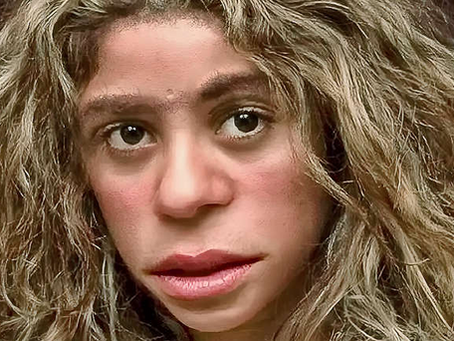 Scientists Discover Girl Born From Two Different Species