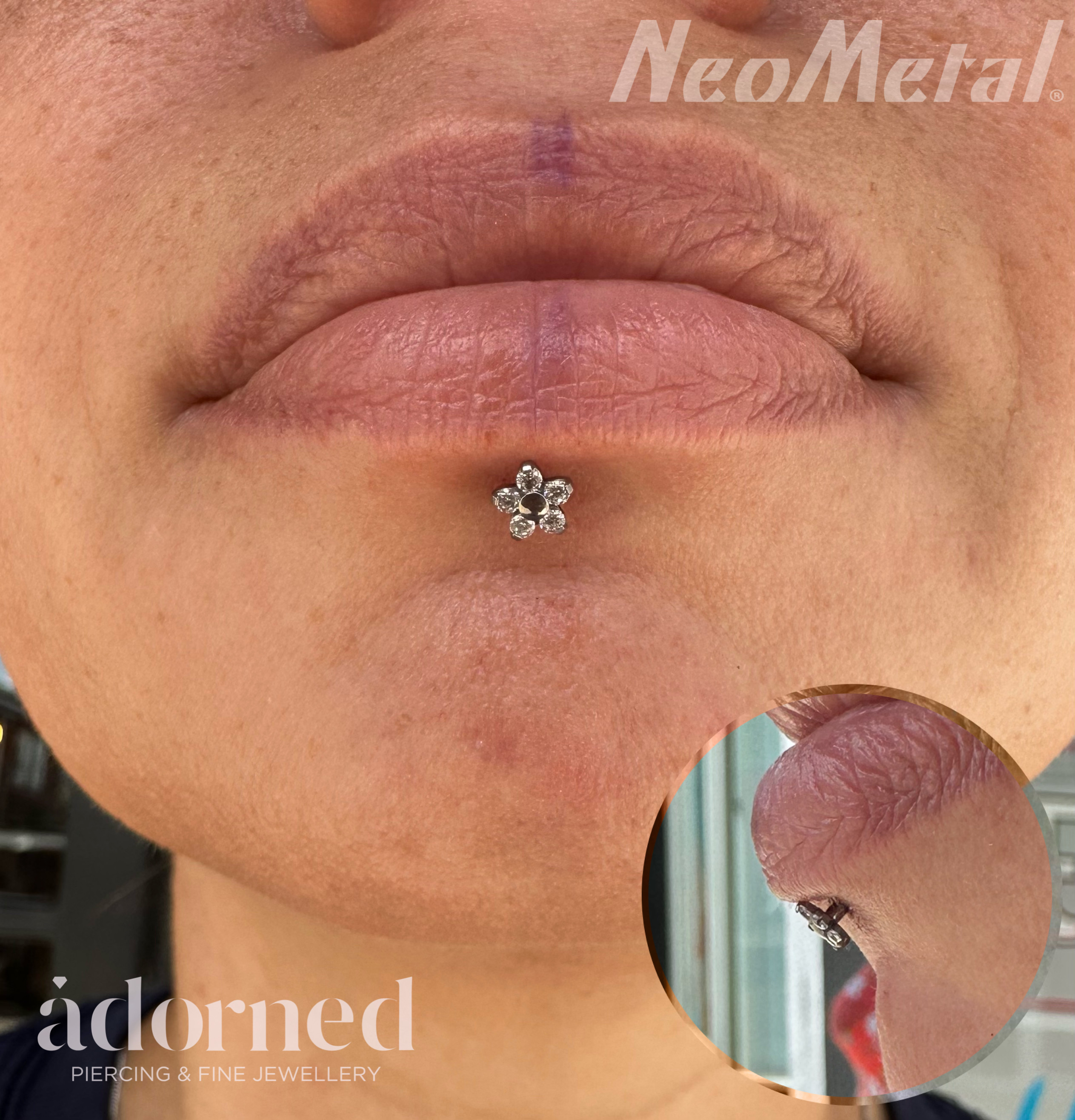 Upper store lip piercing