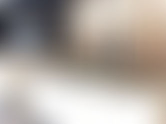 Use Case- Eyes 360, Optometry