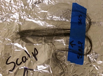 Hair sample