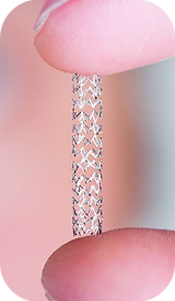 Angioplastia coronaria