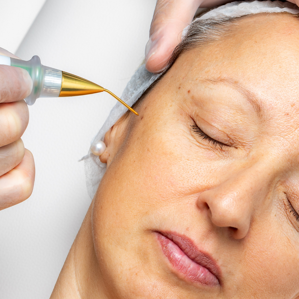 Fibroblast Plasma: What You Need to Know