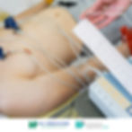 ECG Test in the Philippines