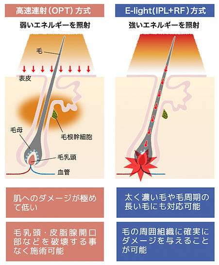 石川県小松市小接骨院猫背矯正骨盤矯正メンズ脱毛リラクゼーション