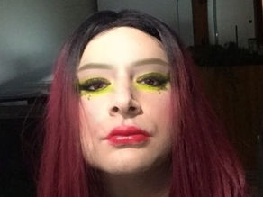 Pre-Op Picture of me!