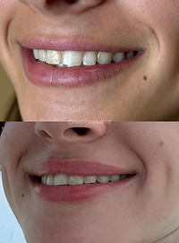 _sknhausmia (1080 x 1920 px) 2.png.PNG