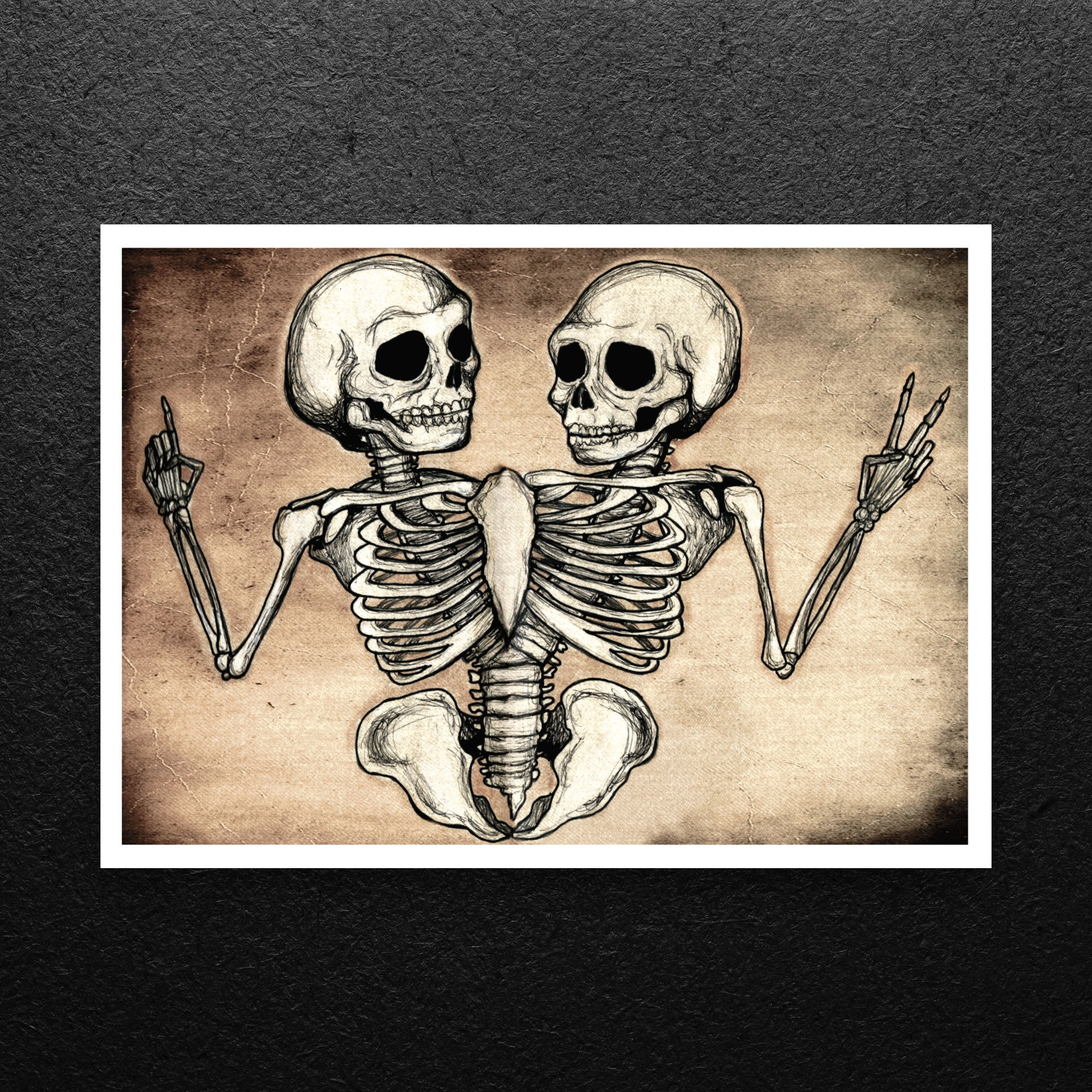 Conjoined Twins Print
