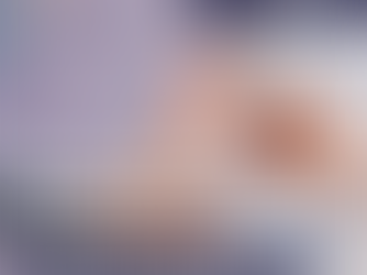 Neuropatia diabética!