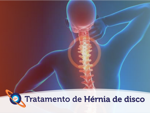 Ozonioterapia aplicado no Tratamento de hérnia de disco