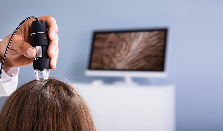 un'analisi del capello con videodermatoscopia digitale La Spezia, SP, Italy