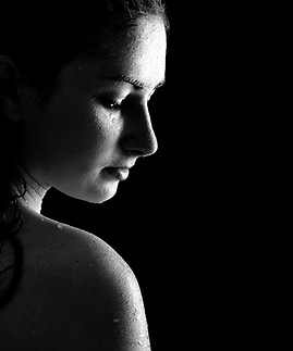 hyperhidrosis-bedfordshire