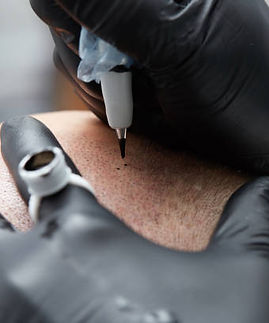 scalp-tattooing-milton-keynes