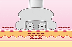 img_super_celum_plus_02.gif