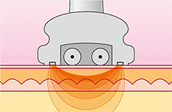 img_super_celum_plus_03.gif