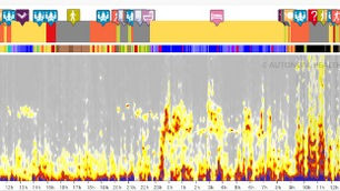 Was ist eigentlich die Herzratenvariabilität?