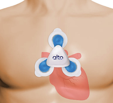 holter monitor_edited.jpg