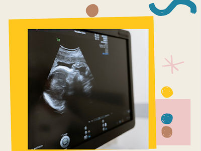 Understanding The ATNR From Early Gestation