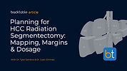 Planning for HCC Radiation Segmentectomy: Mapping, Margins & Dosage
