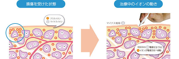 rebox_principle_pic05.jpg