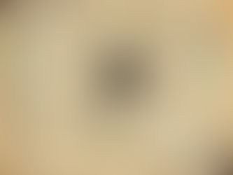 Anavex Life Sciences Submitted Request for EMA to Re-Examine Its Opinion