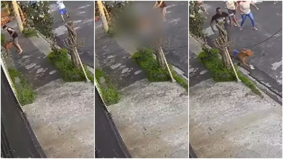 Menino de 12 anos ficou gravemente ferido após ataque de pitbull em São Carlos, SP — Foto: Reprodução