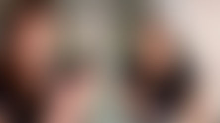 Condição rara impede mulher de virar palma das mãos para cima, e improviso para carregar objetos viraliza.
