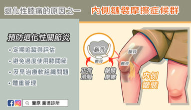 退化性膝痛的原因之一:內側皺襞摩擦症候群