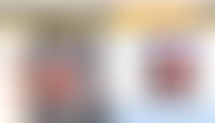 退化性髖關節炎