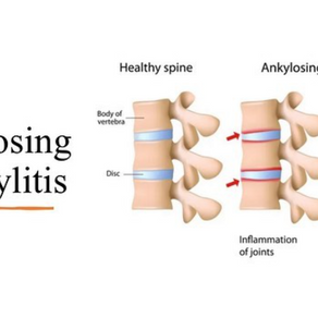 Lower back pain? You must read this!