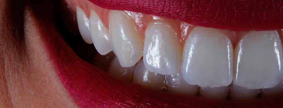institutodaboca.com.br-periodontia-esp-periodontia.jpg