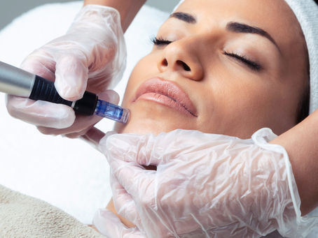 Microneedling Facials Queens NY: Rejuvenate Your Skin with Expert Care