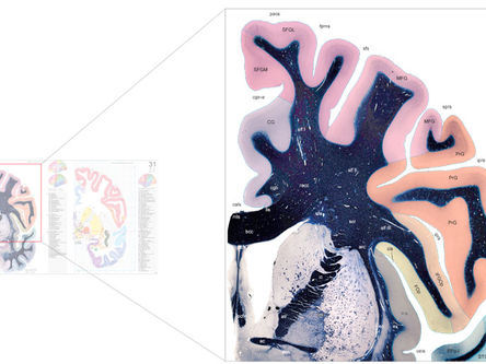 ATLAS OF THE HUMAN BRAIN