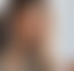 'Cortisol Face': ¿Por qué tu rostro se ve cansado sin importar cuánto duermas?