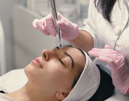 Dermapen, El Secreto para una Piel de Porcelana✨