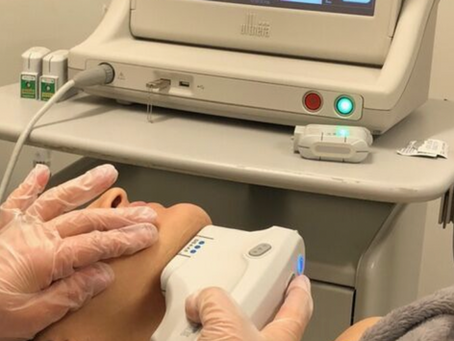 Todo lo que debes saber sobre Ultherapy: El lifting sin cirugía