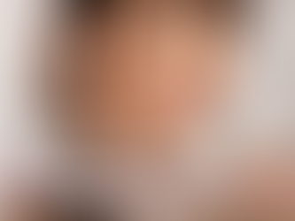 Descubre el Secreto de la Regeneración Celular: ADN de Salmón de Skymedic en Beauty Zone Spa