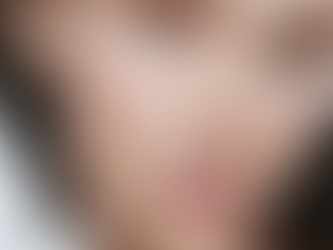 Bioestimuladores y Esperma de Salmón: La Revolución en el Cuidado Facial