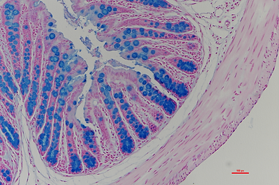 Mast Cell